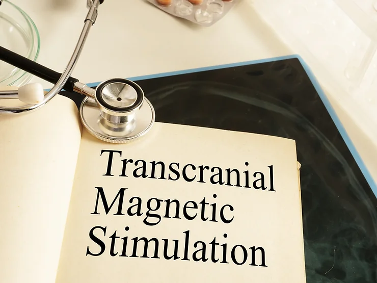 Stethoscope placed next to a document titled 'Transcranial Magnetic Stimulation,' representing medical oversight in TMS therapy.